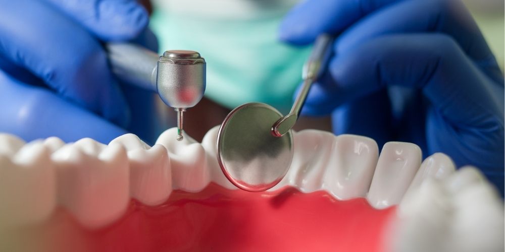 imagen de endodoncia clinica dental ibarreta